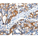 Immunohistochemistry - ITGAX Antibody from Signalway Antibody (36961) - Antibodies.com