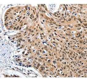 Immunohistochemistry - ITGAM Antibody from Signalway Antibody (36962) - Antibodies.com