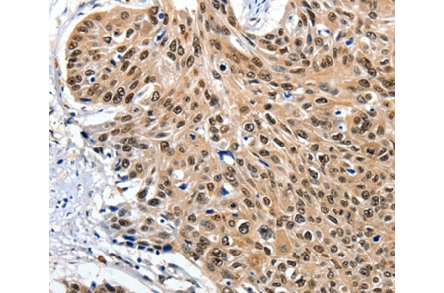 Immunohistochemistry - ITGAM Antibody from Signalway Antibody (36962) - Antibodies.com
