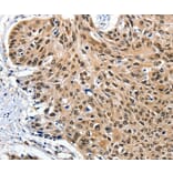 Immunohistochemistry - ITGAM Antibody from Signalway Antibody (36962) - Antibodies.com