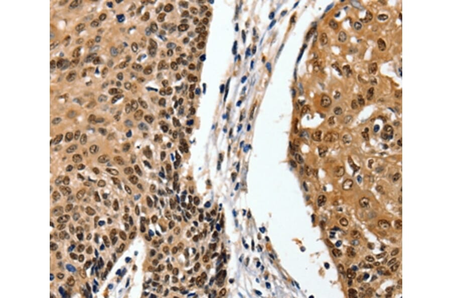 Immunohistochemistry - ITGAM Antibody from Signalway Antibody (36962) - Antibodies.com