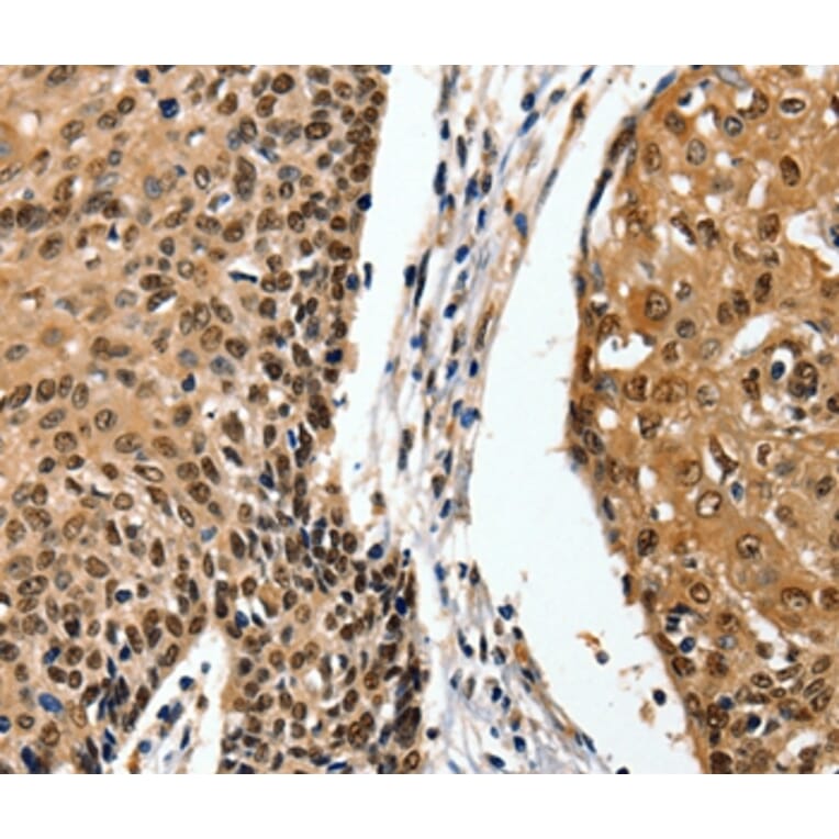 Immunohistochemistry - ITGAM Antibody from Signalway Antibody (36962) - Antibodies.com