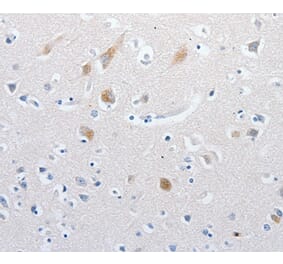 Immunohistochemistry - MATN1 Antibody from Signalway Antibody (36966) - Antibodies.com