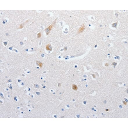 Immunohistochemistry - MATN1 Antibody from Signalway Antibody (36966) - Antibodies.com