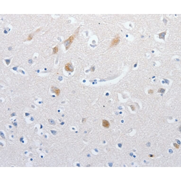 Immunohistochemistry - MATN1 Antibody from Signalway Antibody (36966) - Antibodies.com