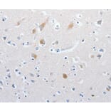 Immunohistochemistry - MATN1 Antibody from Signalway Antibody (36966) - Antibodies.com