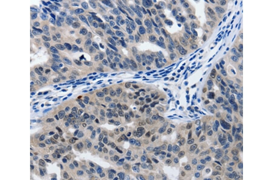 Immunohistochemistry - MATN1 Antibody from Signalway Antibody (36966) - Antibodies.com
