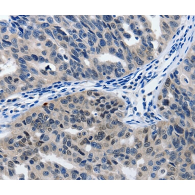 Immunohistochemistry - MATN1 Antibody from Signalway Antibody (36966) - Antibodies.com