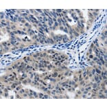 Immunohistochemistry - MATN1 Antibody from Signalway Antibody (36966) - Antibodies.com