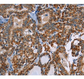 Immunohistochemistry - ABCB1 Antibody from Signalway Antibody (36980) - Antibodies.com