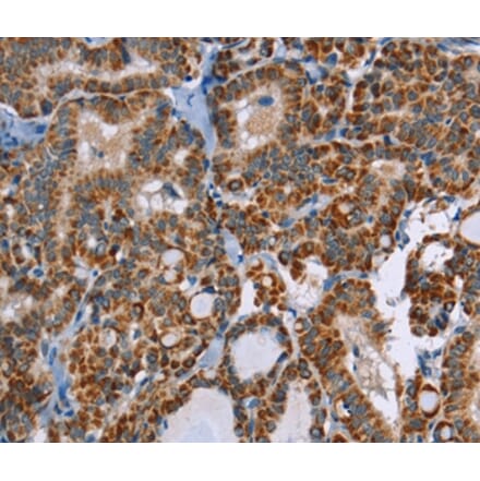 Immunohistochemistry - ABCB1 Antibody from Signalway Antibody (36980) - Antibodies.com