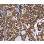Immunohistochemistry - ABCB1 Antibody from Signalway Antibody (36980) - Antibodies.com