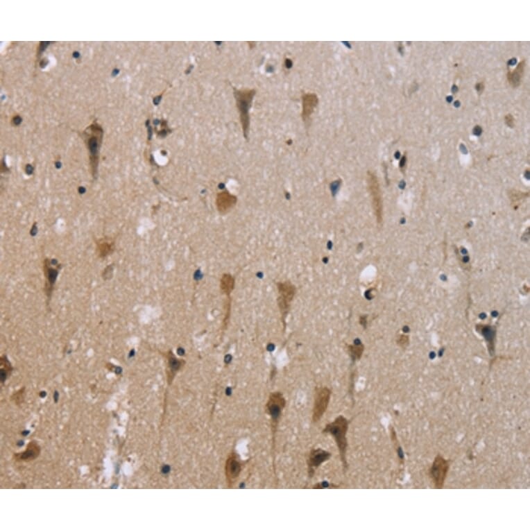 Immunohistochemistry - ABCB1 Antibody from Signalway Antibody (36980) - Antibodies.com