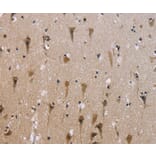 Immunohistochemistry - ABCB1 Antibody from Signalway Antibody (36980) - Antibodies.com