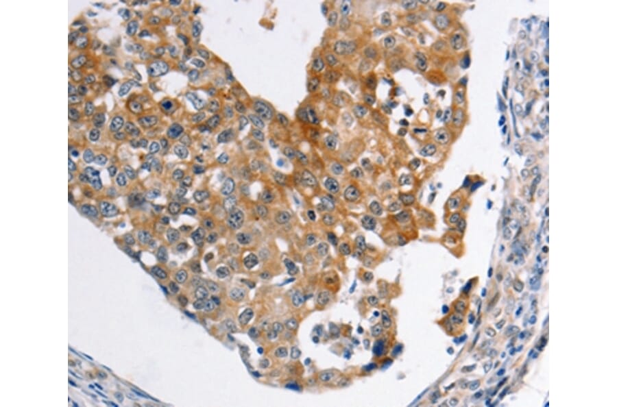 Immunohistochemistry - ABCC3 Antibody from Signalway Antibody (36982) - Antibodies.com
