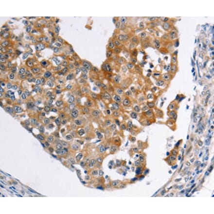 Immunohistochemistry - ABCC3 Antibody from Signalway Antibody (36982) - Antibodies.com