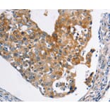 Immunohistochemistry - ABCC3 Antibody from Signalway Antibody (36982) - Antibodies.com