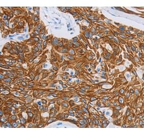 Immunohistochemistry - MMP21 Antibody from Signalway Antibody (36985) - Antibodies.com