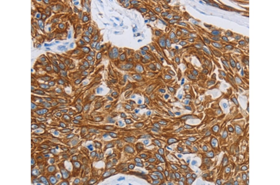 Immunohistochemistry - MMP21 Antibody from Signalway Antibody (36985) - Antibodies.com