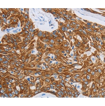 Immunohistochemistry - MMP21 Antibody from Signalway Antibody (36985) - Antibodies.com