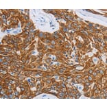 Immunohistochemistry - MMP21 Antibody from Signalway Antibody (36985) - Antibodies.com