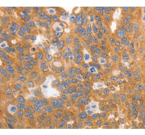 Immunohistochemistry - MYOD1 Antibody from Signalway Antibody (36992) - Antibodies.com