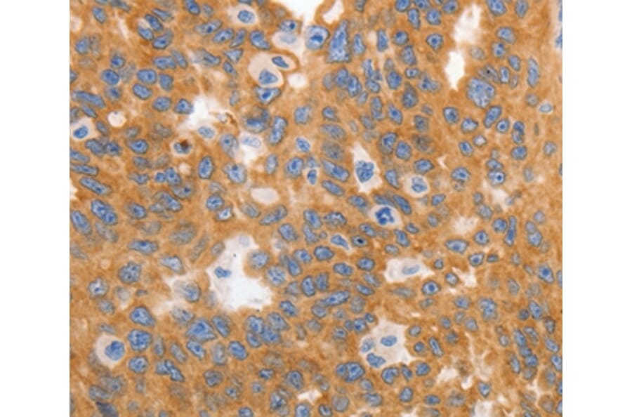 Immunohistochemistry - MYOD1 Antibody from Signalway Antibody (36992) - Antibodies.com