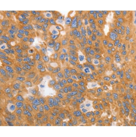 Immunohistochemistry - MYOD1 Antibody from Signalway Antibody (36992) - Antibodies.com