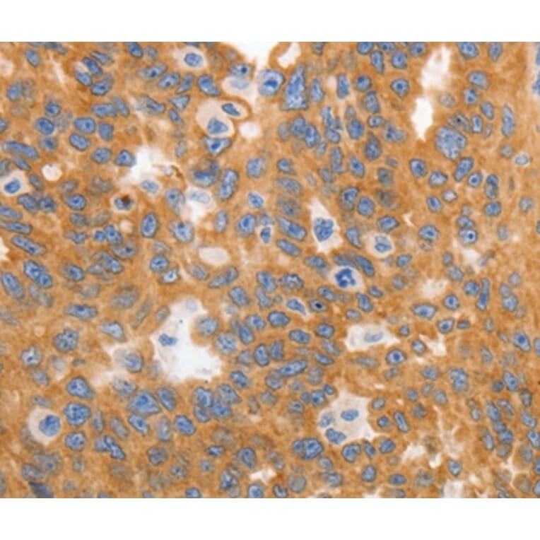 Immunohistochemistry - MYOD1 Antibody from Signalway Antibody (36992) - Antibodies.com
