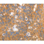 Immunohistochemistry - MYOD1 Antibody from Signalway Antibody (36992) - Antibodies.com