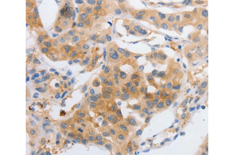 Immunohistochemistry - MYOD1 Antibody from Signalway Antibody (36992) - Antibodies.com