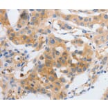 Immunohistochemistry - MYOD1 Antibody from Signalway Antibody (36992) - Antibodies.com