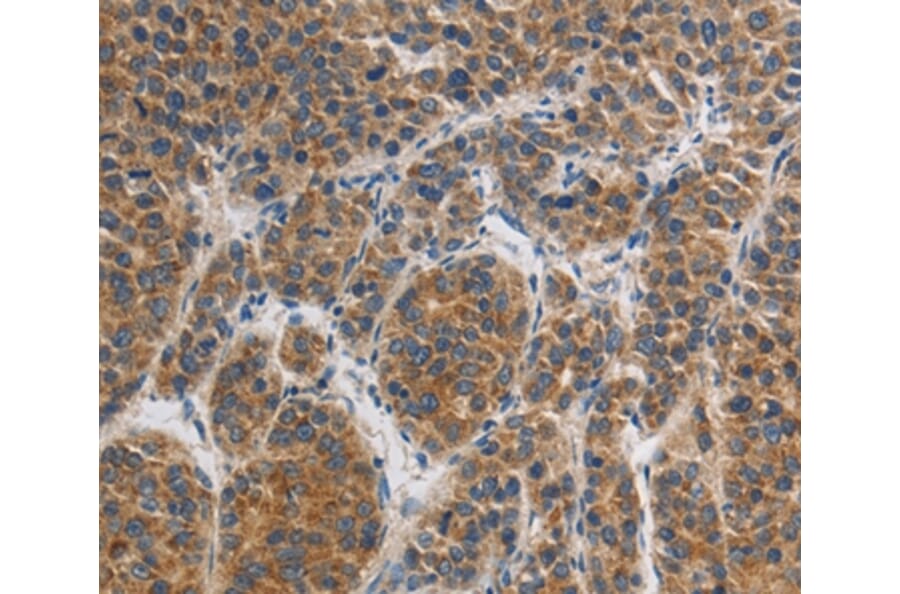 Immunohistochemistry - GRIN1 Antibody from Signalway Antibody (37001) - Antibodies.com
