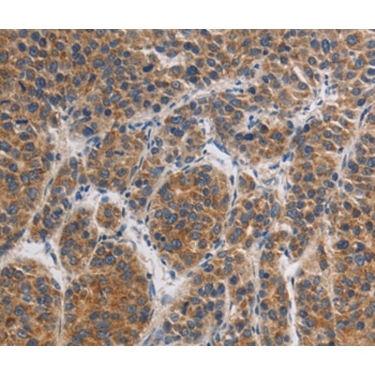 Immunohistochemistry - GRIN1 Antibody from Signalway Antibody (37001) - Antibodies.com