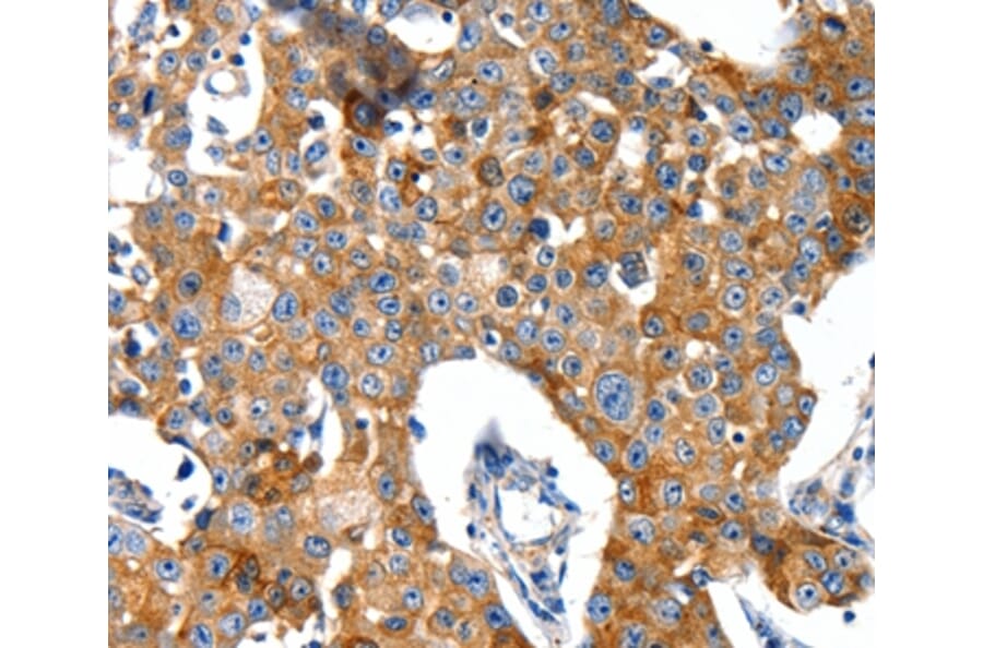 Immunohistochemistry - GRIA2 Antibody from Signalway Antibody (37006) - Antibodies.com