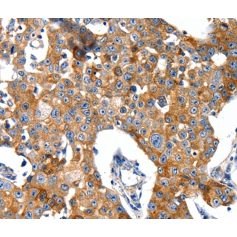 Immunohistochemistry - GRIA2 Antibody from Signalway Antibody (37006) - Antibodies.com