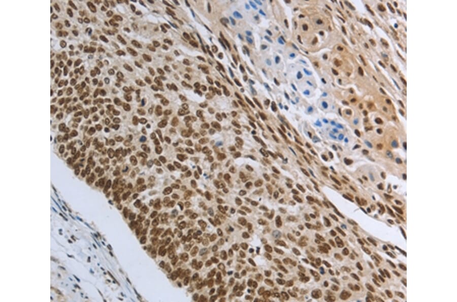 Immunohistochemistry - PRMT3 Antibody from Signalway Antibody (37020) - Antibodies.com