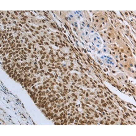 Immunohistochemistry - PRMT3 Antibody from Signalway Antibody (37020) - Antibodies.com