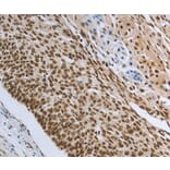 Immunohistochemistry - PRMT3 Antibody from Signalway Antibody (37020) - Antibodies.com