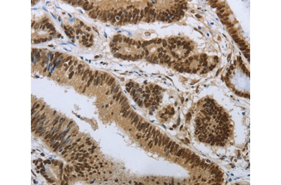 Immunohistochemistry - PRMT3 Antibody from Signalway Antibody (37020) - Antibodies.com
