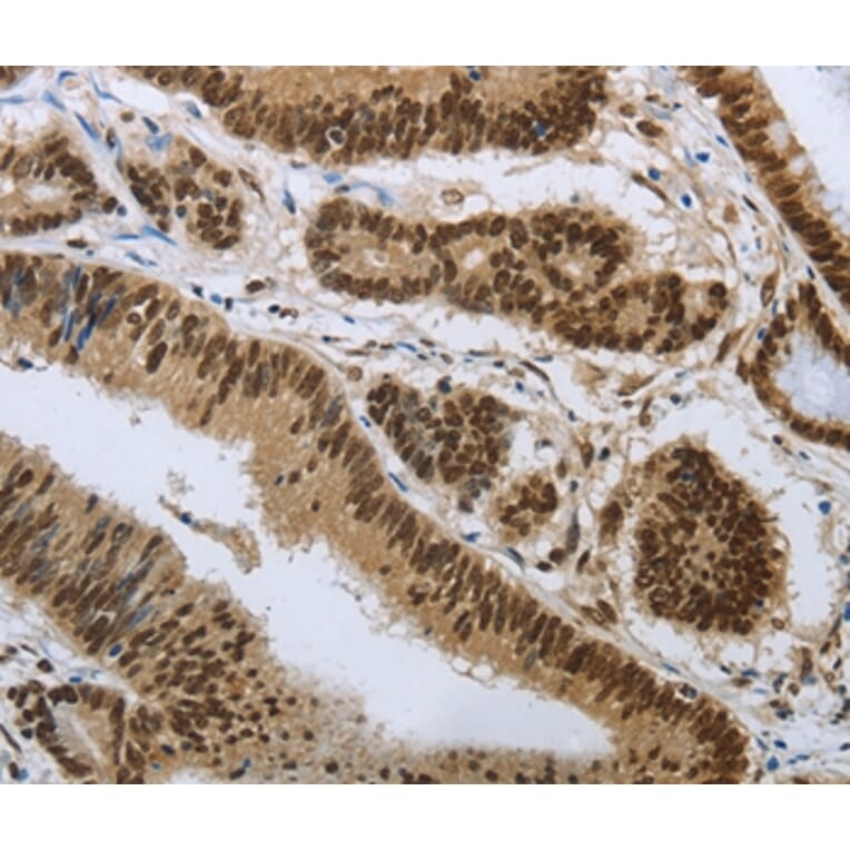Immunohistochemistry - PRMT3 Antibody from Signalway Antibody (37020) - Antibodies.com