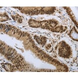Immunohistochemistry - PRMT3 Antibody from Signalway Antibody (37020) - Antibodies.com