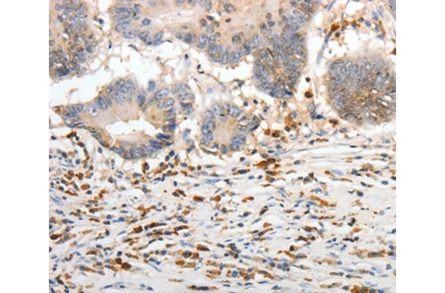 Immunohistochemistry - PTTG2 Antibody from Signalway Antibody (37021) - Antibodies.com