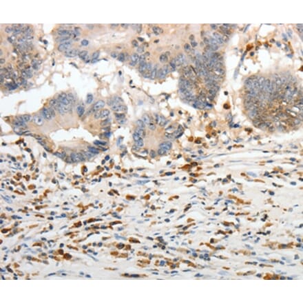 Immunohistochemistry - PTTG2 Antibody from Signalway Antibody (37021) - Antibodies.com
