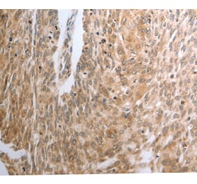 Immunohistochemistry - RAD51 Antibody from Signalway Antibody (37022) - Antibodies.com
