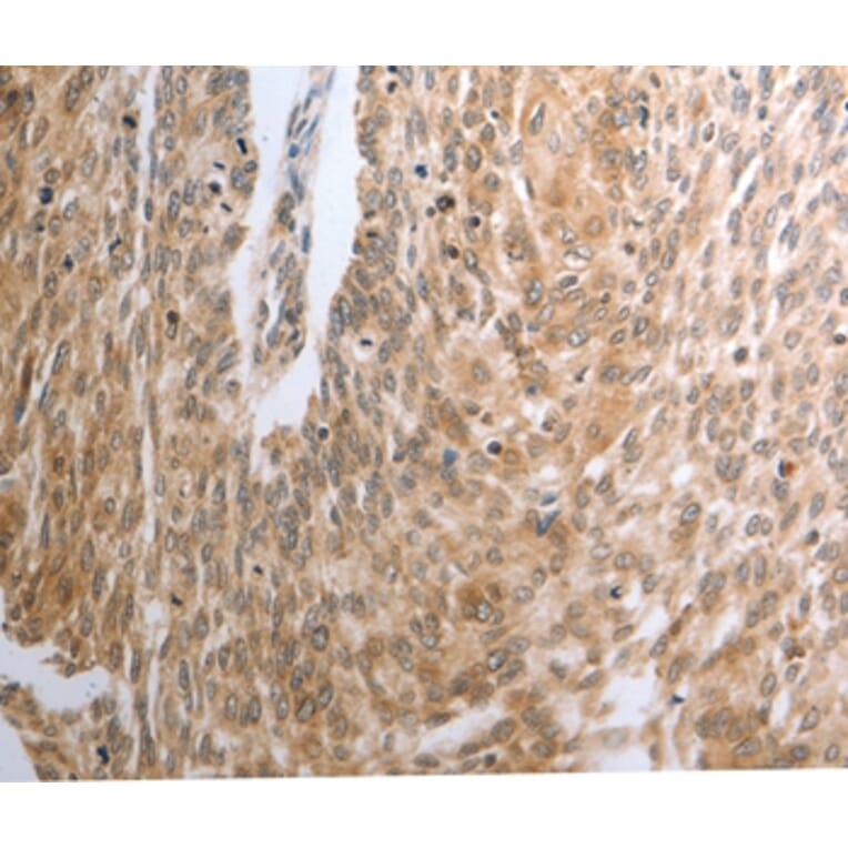 Immunohistochemistry - RAD51 Antibody from Signalway Antibody (37022) - Antibodies.com