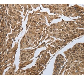 Immunohistochemistry - MYH11 Antibody from Signalway Antibody (37037) - Antibodies.com