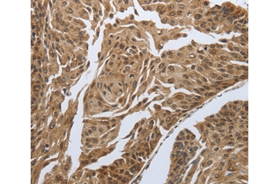 Immunohistochemistry - MYH11 Antibody from Signalway Antibody (37037) - Antibodies.com