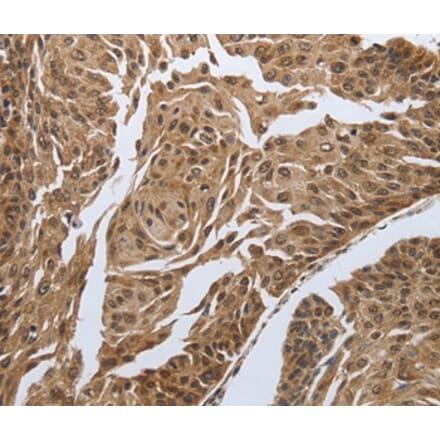 Immunohistochemistry - MYH11 Antibody from Signalway Antibody (37037) - Antibodies.com