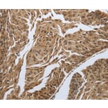 Immunohistochemistry - MYH11 Antibody from Signalway Antibody (37037) - Antibodies.com
